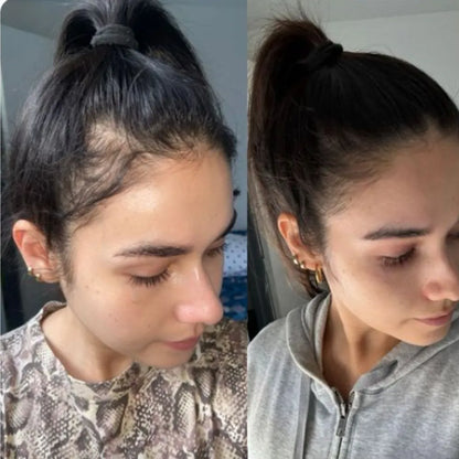 Kit anticaída para un cabello más fuerte, grueso y saludable